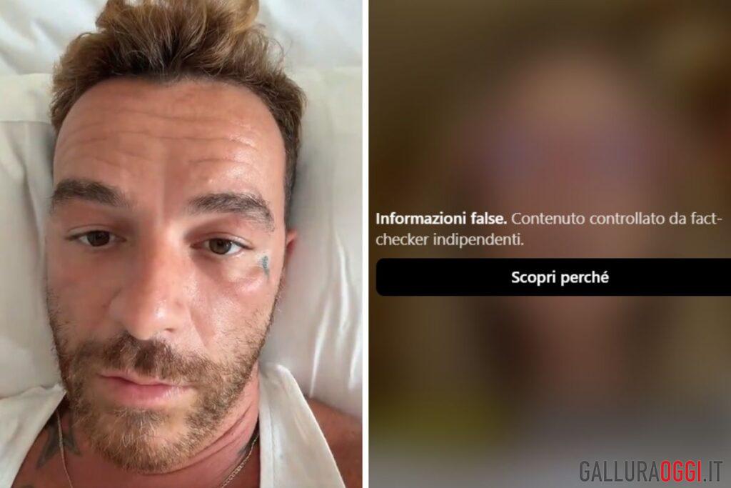 salmo melanoma video cancro alla pelle