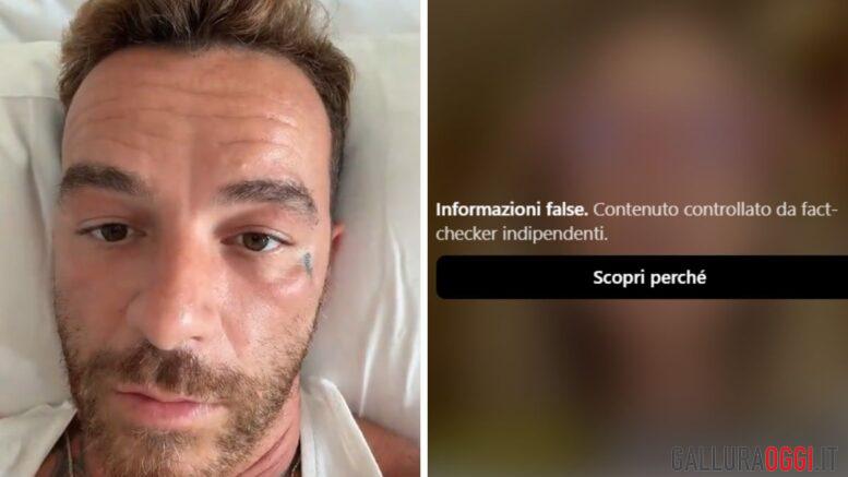 salmo melanoma video cancro alla pelle